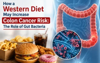 How a Western Diet May Increase Colon Cancer Risk: The Role of Gut Bacteria